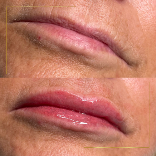 lippblush